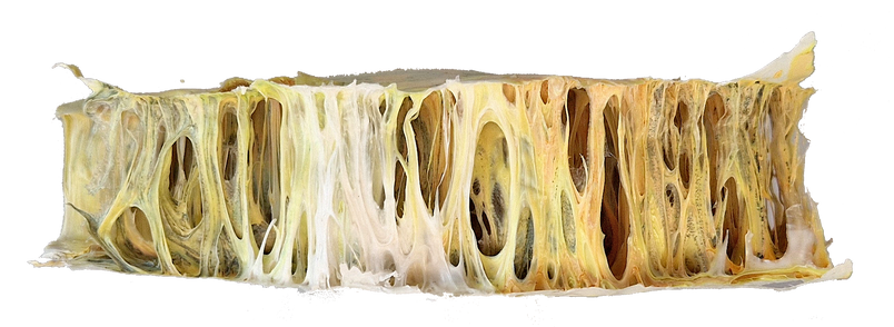 Elongated structure with net-like pattern and light yellow tone